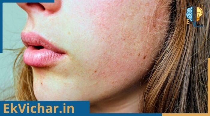सर्दी में रूखी त्वचा कि देखभाल
